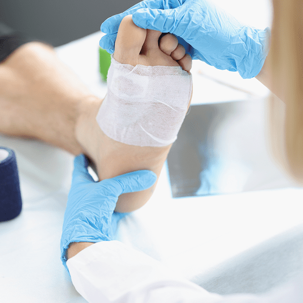 Foot bandage being applied by gloved hands.
