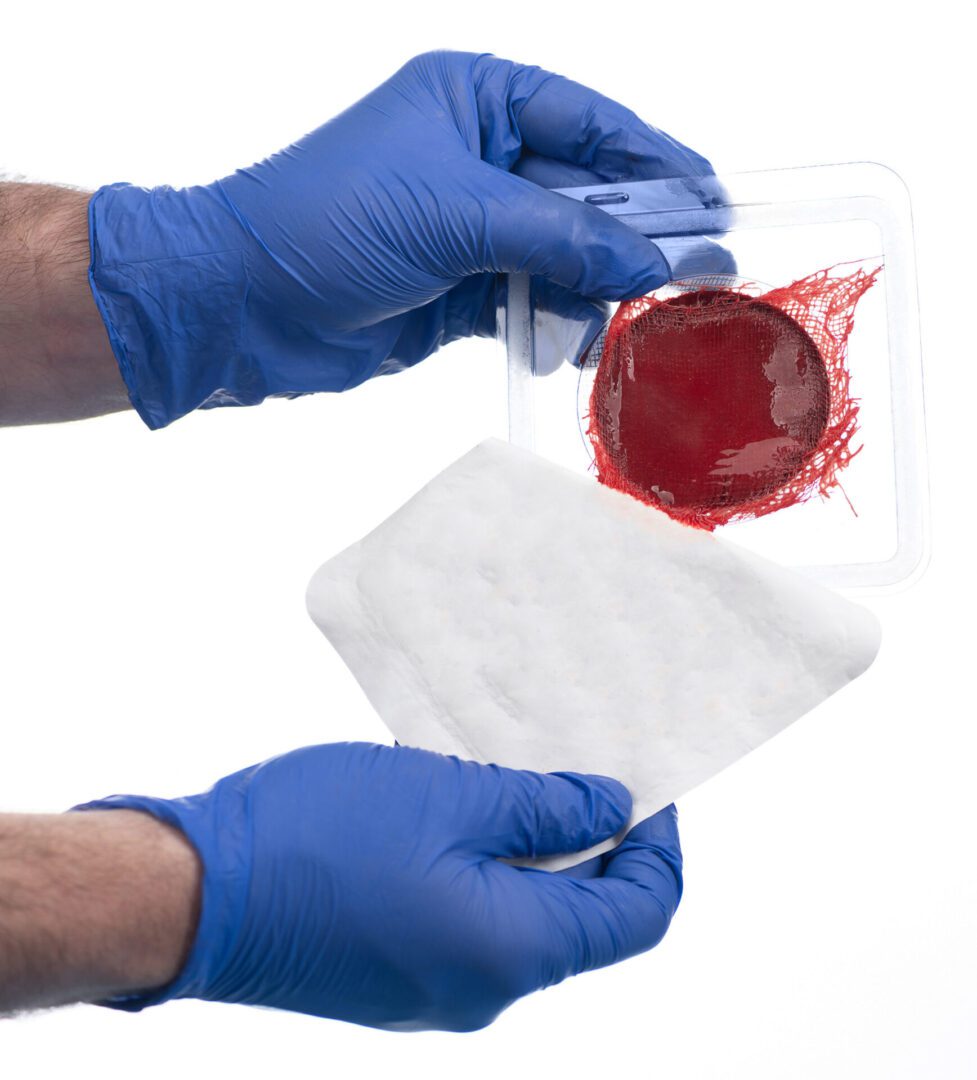 Gloved hands handling a medical wound dressing.