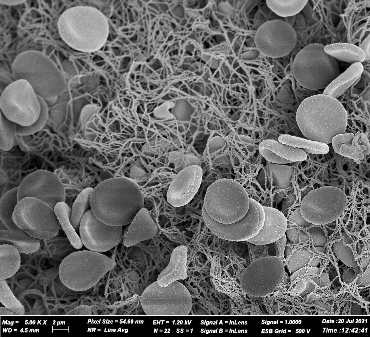 Microscopic view of red blood cells.