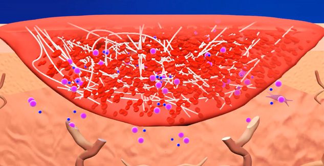Illustration of blood clotting in a wound.