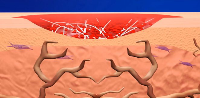 Illustration of wound healing and tissue repair.